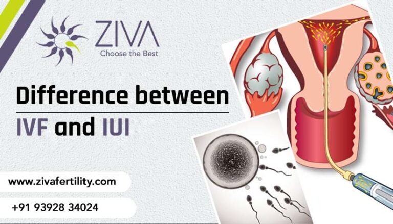 Difference Between Ivf And Iui Ziva Fertility 0120