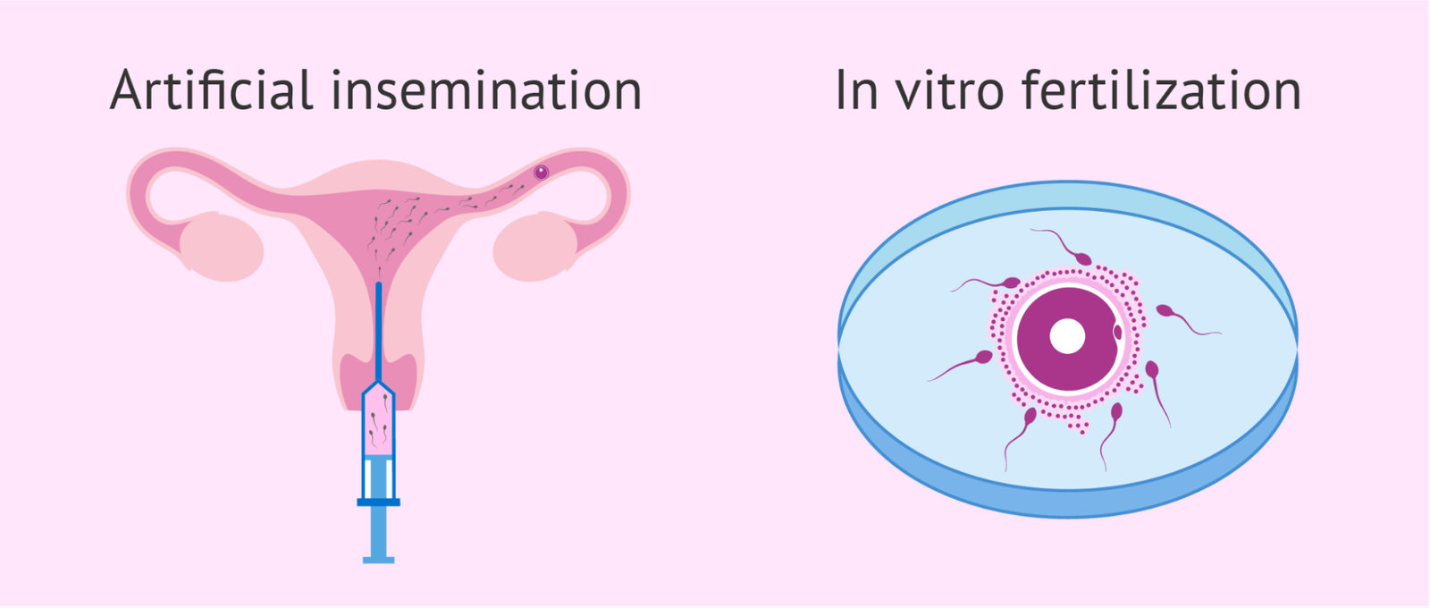 Ziva fertility and IVF center Hyderabad Telangana, reproductive endocrinologist near Langarhouz