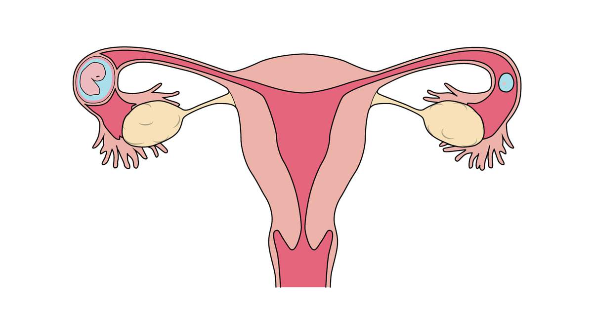 Best female infertility treatment in Hyderabad, male fertility doctor near Banjara Hills