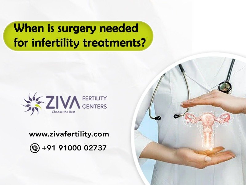 Read more about the article When is surgery needed for infertility treatments?