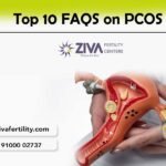 Top 10 FAQS on PCOS