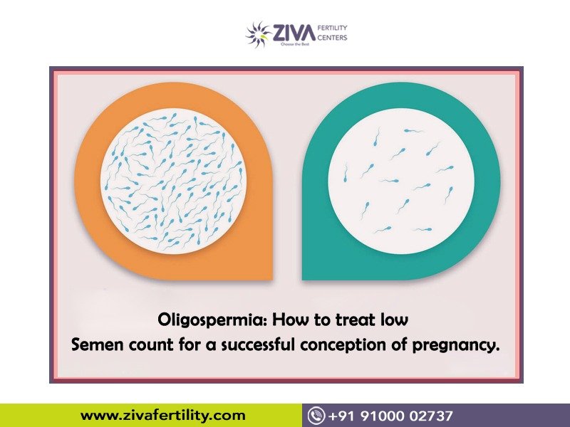 Consult Ziva Fertility Center for Guied to How to Treat Low Semen Count, infertility treatment near me