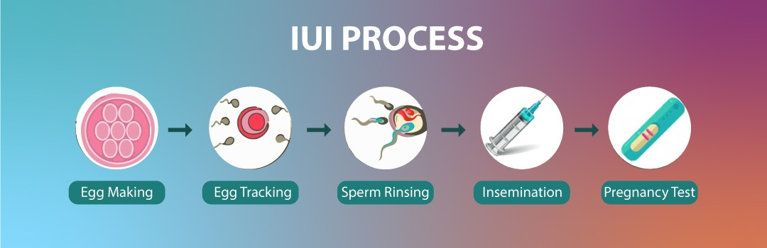 Consult IUI Specialist near me and get the Best IUI Treatment In Hyderabad