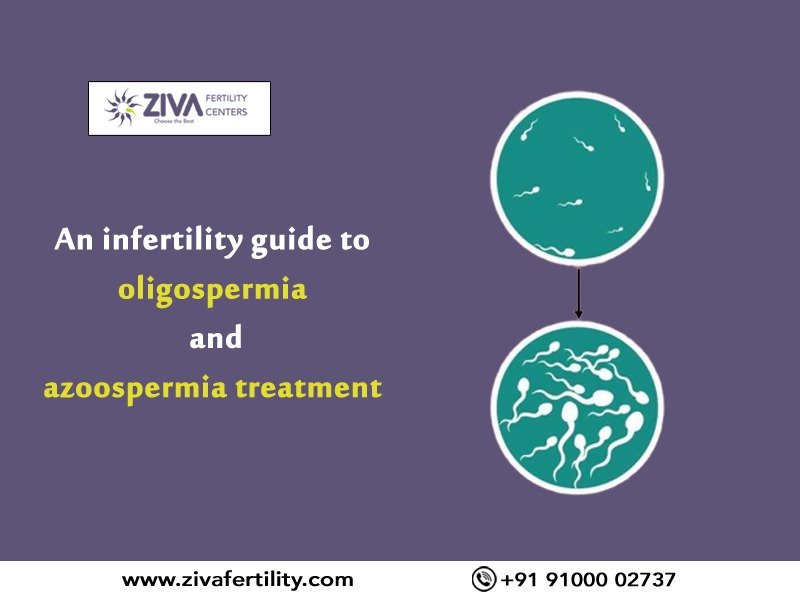 Read more about the article An infertility guide to oligospermia and azoospermia treatment