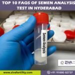 Top 10 FAQs of Semen analysis test in Hyderabad