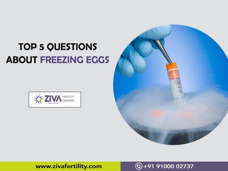 Read more about the article Top 5 questions about freezing eggs