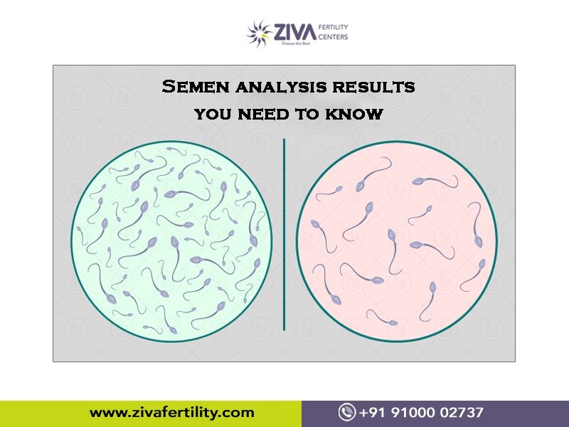 Parameters analysed in the semen analysis