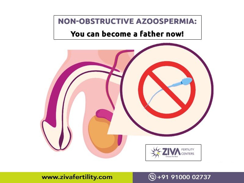 Read more about the article Non-obstructive azoospermia: You can become a father now!