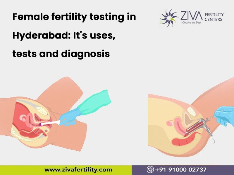 Read more about the article Female fertility testing in Hyderabad: It’s uses, tests and diagnosis