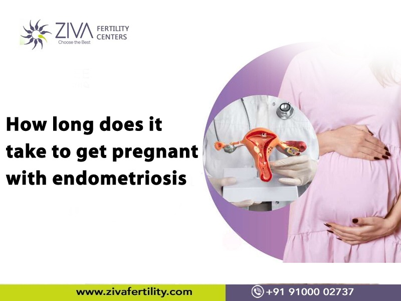 Read more about the article How long does it take to get pregnant with endometriosis?