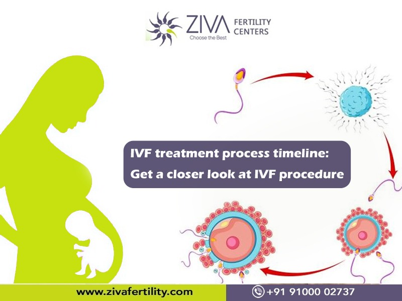 Read more about the article IVF treatment process timeline: Get a closer look at IVF procedure