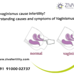 Does vaginismus cause infertility? Understanding the causes and symptoms of Vaginismus