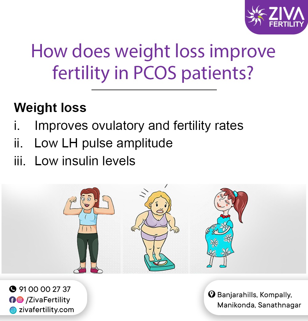 How Does Weight Loss Improve Fertility in PCOS Patients?
