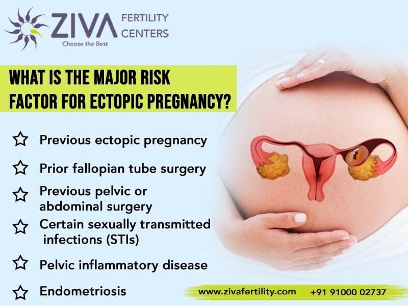 What Is the Major Risk Factor for Ectopic Pregnancy?