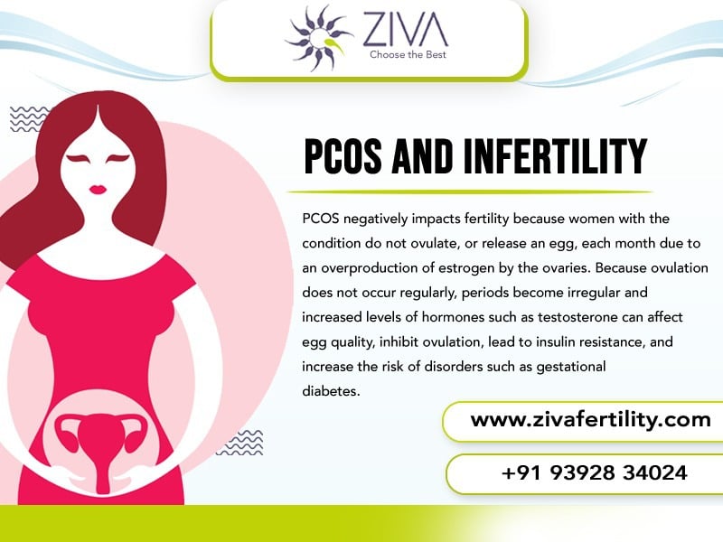 PCOS and Infertility: Understanding the Link