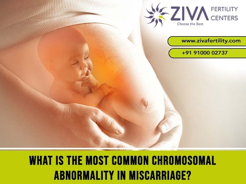 What Is the Most Common Chromosomal Abnormality in Miscarriage?