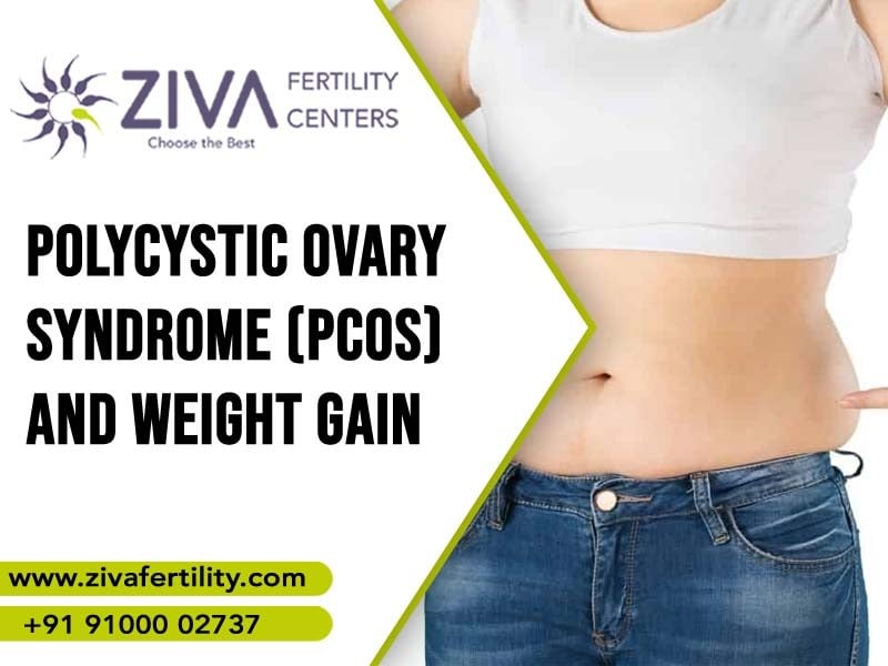 Polycystic Ovary Syndrome (PCOS) and Weight Gain