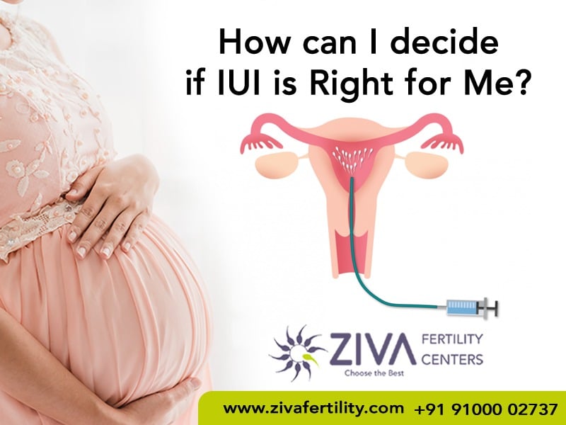 How Can I Decide if IUI is Right for Me?