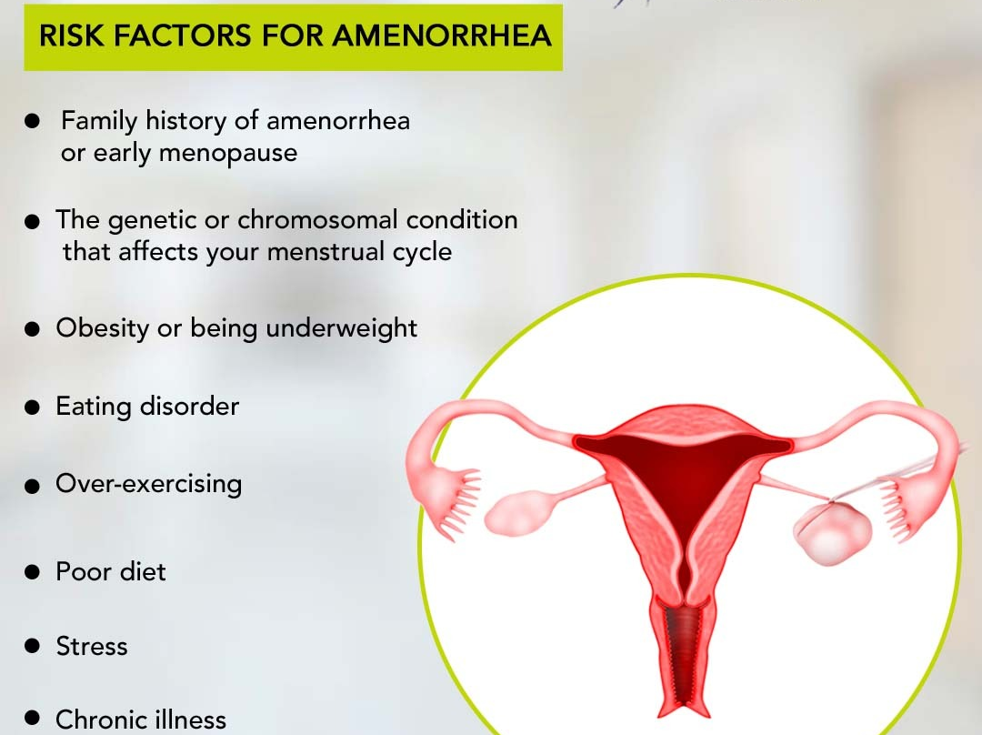 Risk Factors You Must Be Aware of About Amenorrhea