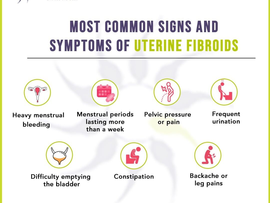 Most Common Signs and Symptoms of Uterine Fibroids