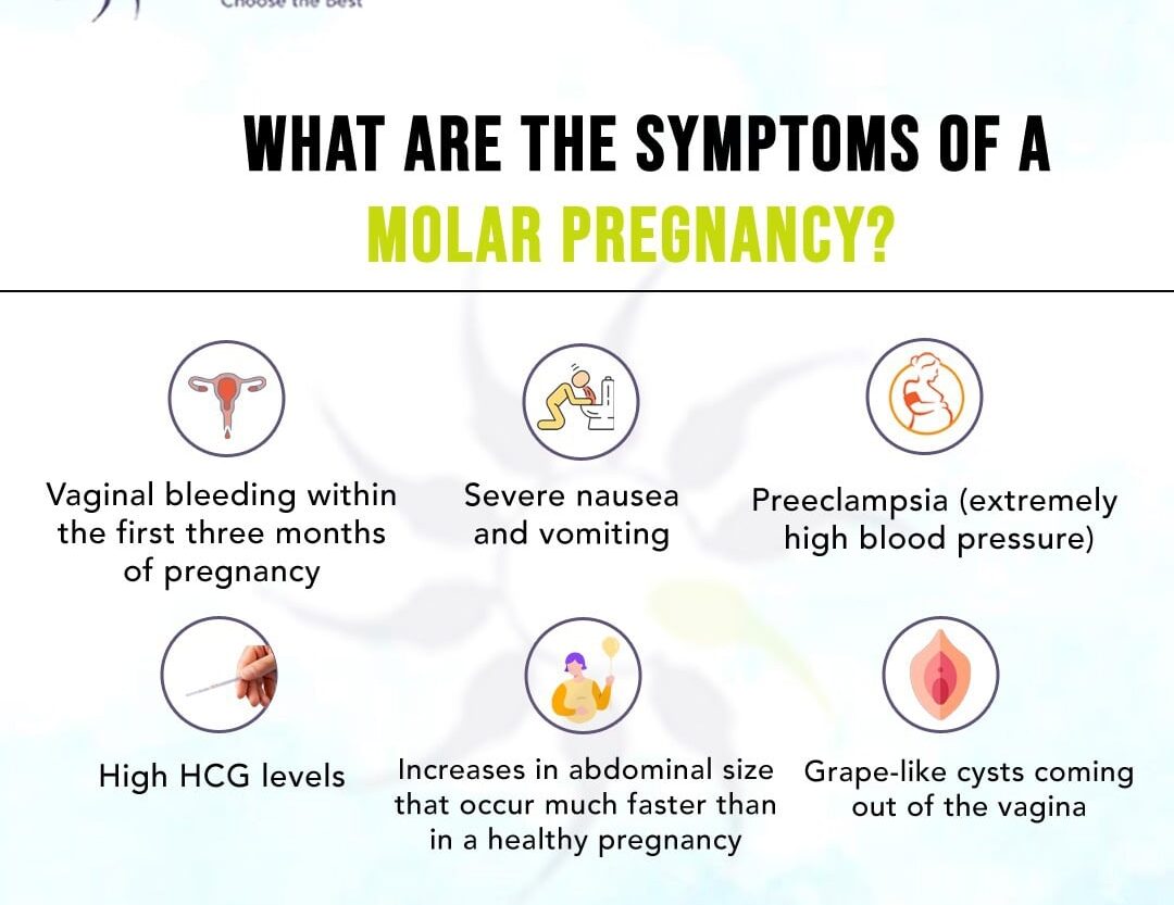 Important Facts You Should Know About Molar Pregnancy