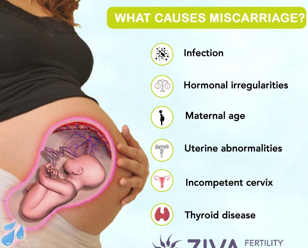 WHAT CAUSES MISCARRIAGE?