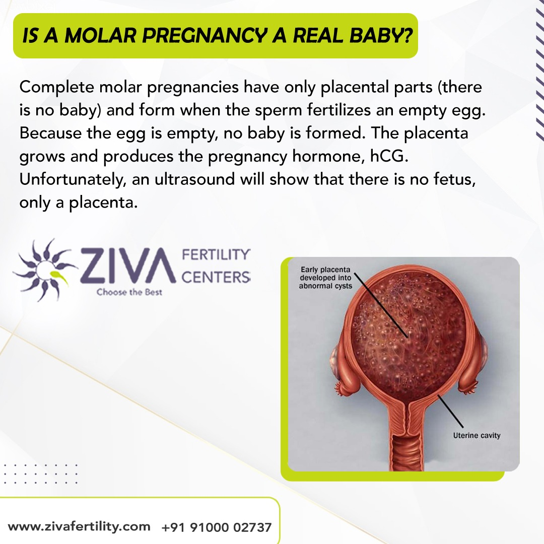 Molar Pregnancy – Is It a Real Baby?