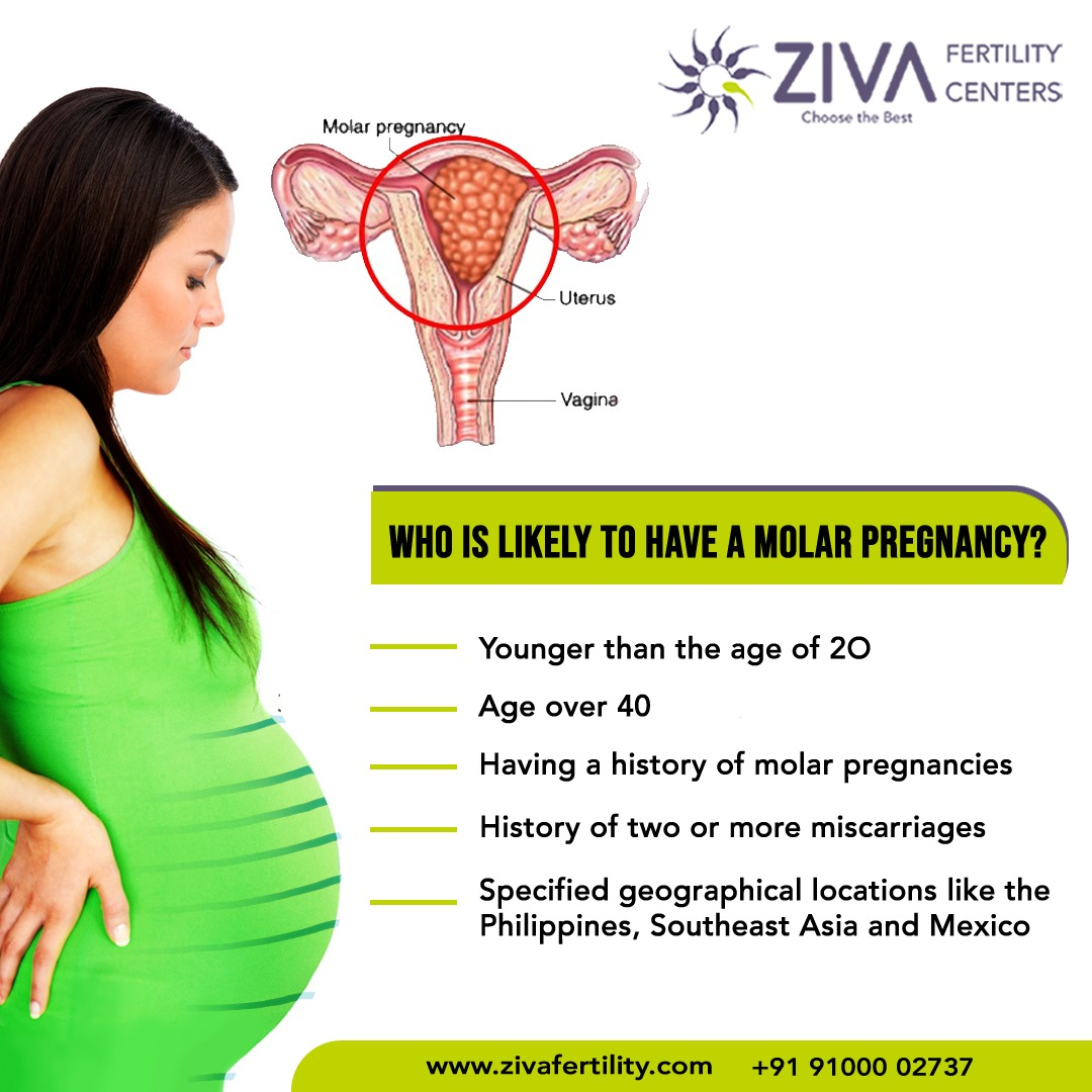 Who Is Likely to Have a Molar Pregnancy?