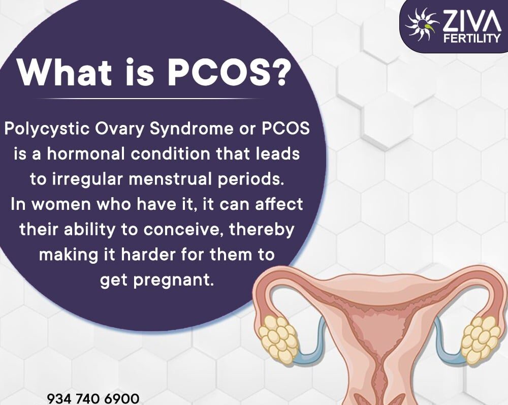 PCOS and Infertility – What is the Connection?