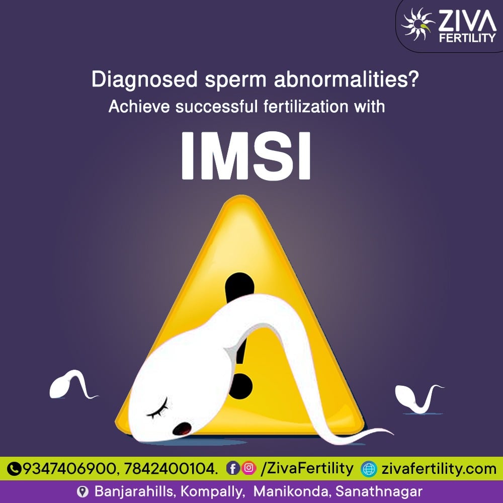 Diagnosed Sperm Abnormalities? Achieve Successful Fertilization with IMSI
