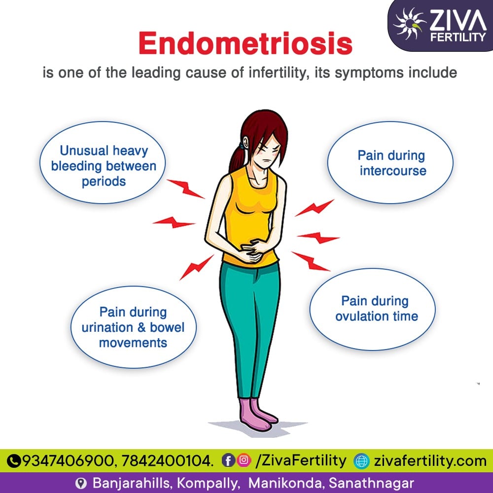 Endometriosis – A Leading Cause of Infertility
